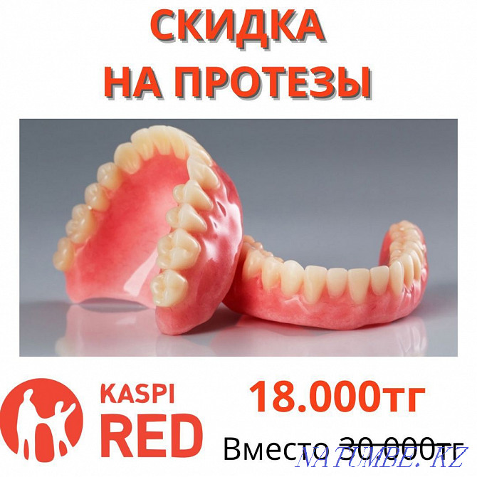 Dentures Dentistry Almaty Veneers Ceramic-metal Braces Implants Almaty - photo 1