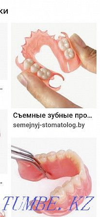 Все виды стоматологической услуги.протез гипки германски Алматы - изображение 4