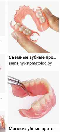 Все виды стоматологической услуги.протез гипки германски Алматы