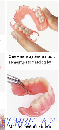 Все виды стоматологической услуги.протез гипки германски Алматы - изображение 2