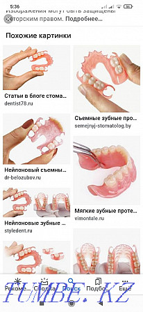 Все виды стоматологической услуги.протез гипки германски Алматы - изображение 3