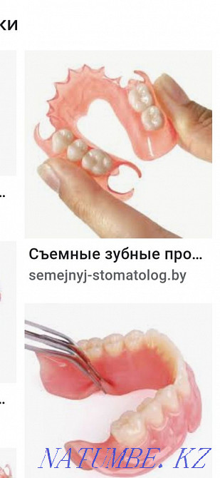 All types of dental services. Gypka prosthesis German Almaty - photo 4