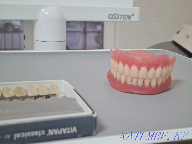 Dentistry Tіs emdeu salu zh?lu removal treatment prosthesis teeth. Almaty - photo 5
