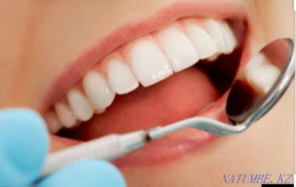 Стоматологиялық қызметтер  Қостанай  - изображение 1