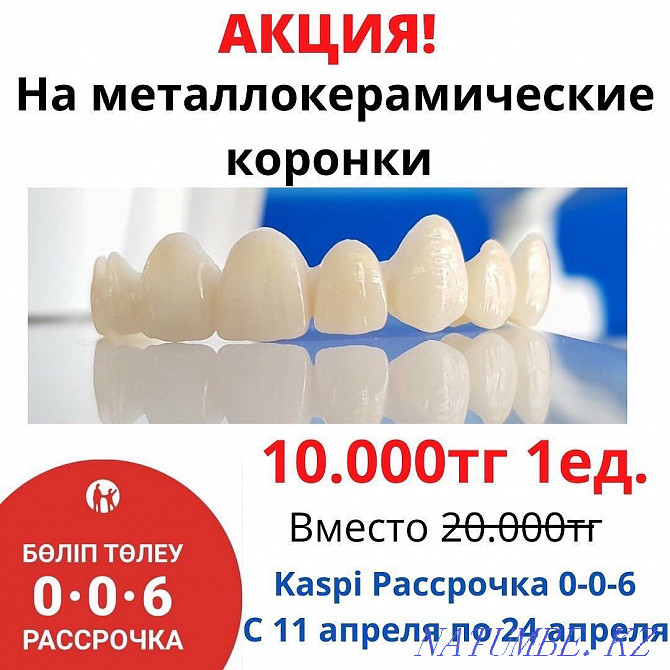 Metal ceramics Dentistry Almaty Dentist Implants Veneers Braces Almaty - photo 1