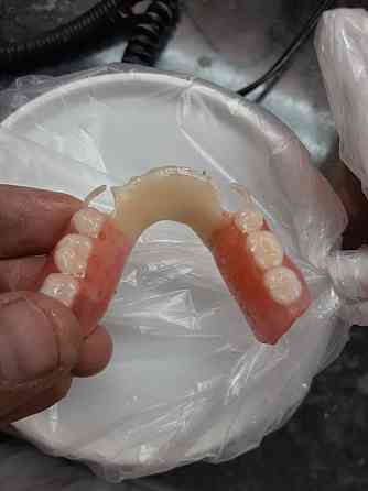 Стоматолог зубной протез Shymkent