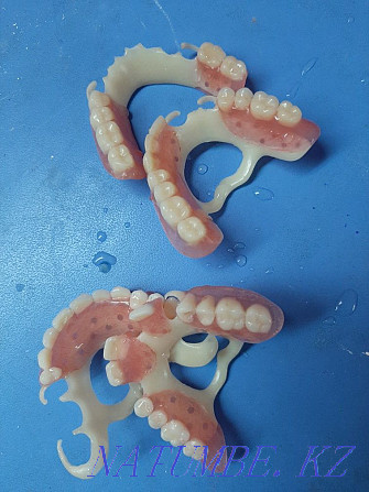 Стоматолог зубной протез Шымкент - изображение 5