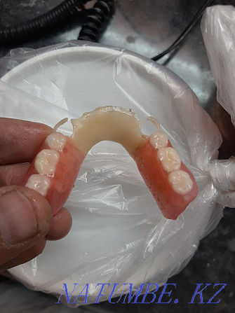 Стоматолог зубной протез Шымкент - изображение 3