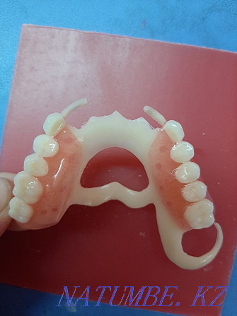 Стоматолог зубной протез Шымкент - изображение 2