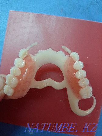 Тіс дәрігерінің протезі Шымкент - изображение 2
