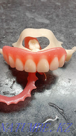 Стоматолог зубной протез Шымкент - изображение 1