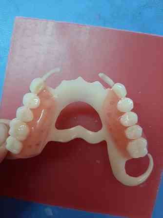 Стоматолог зубной протез Шымкент