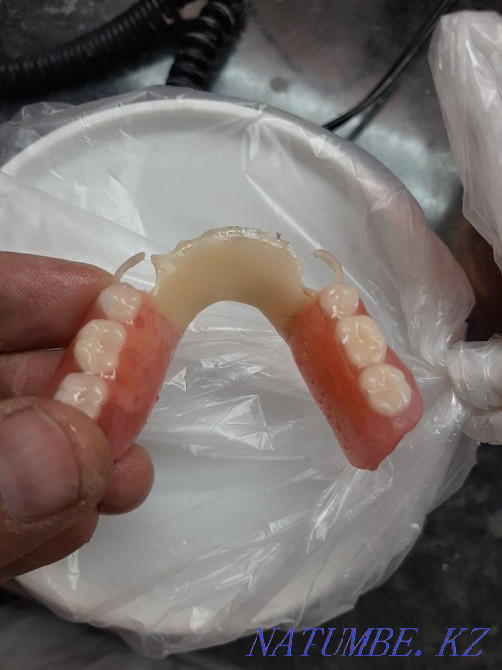 Dentist denture Shymkent - photo 3