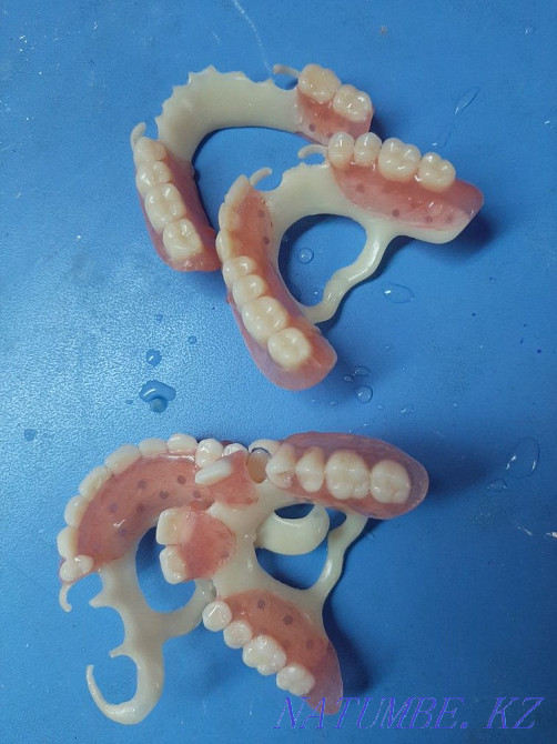 Dentist denture Shymkent - photo 5