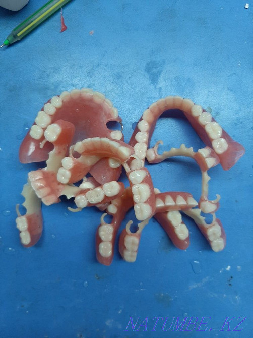 Dentist denture Shymkent - photo 4