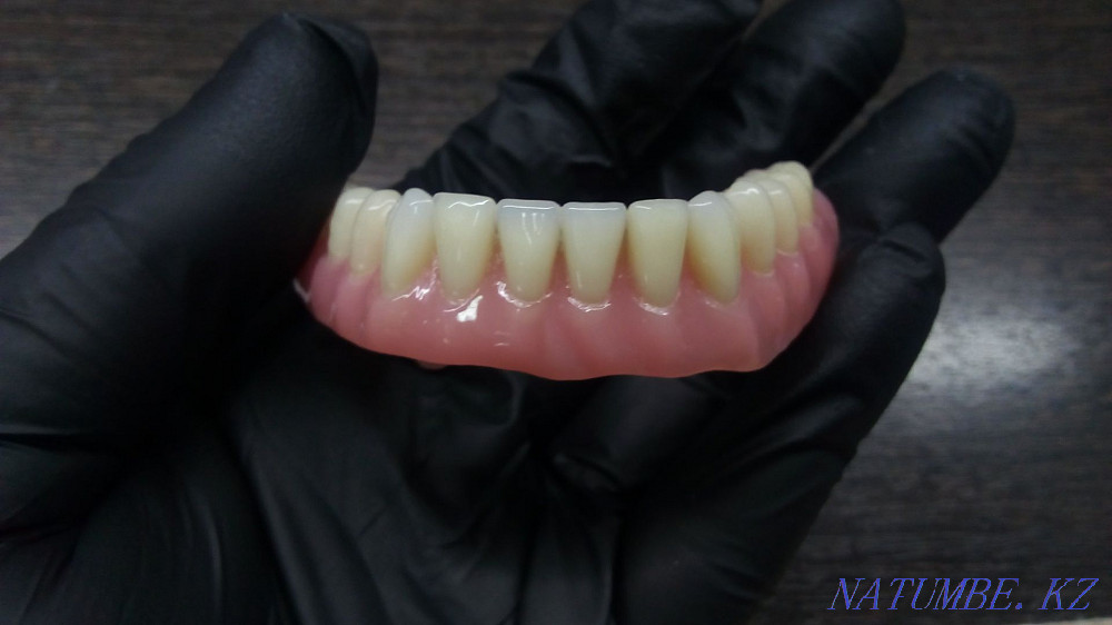 Dental laboratory offers its services! Astana - photo 4