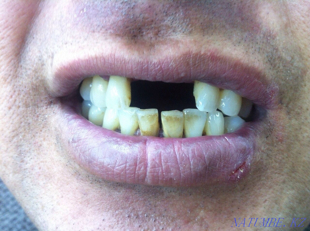 Dental laboratory offers its services! Astana - photo 2