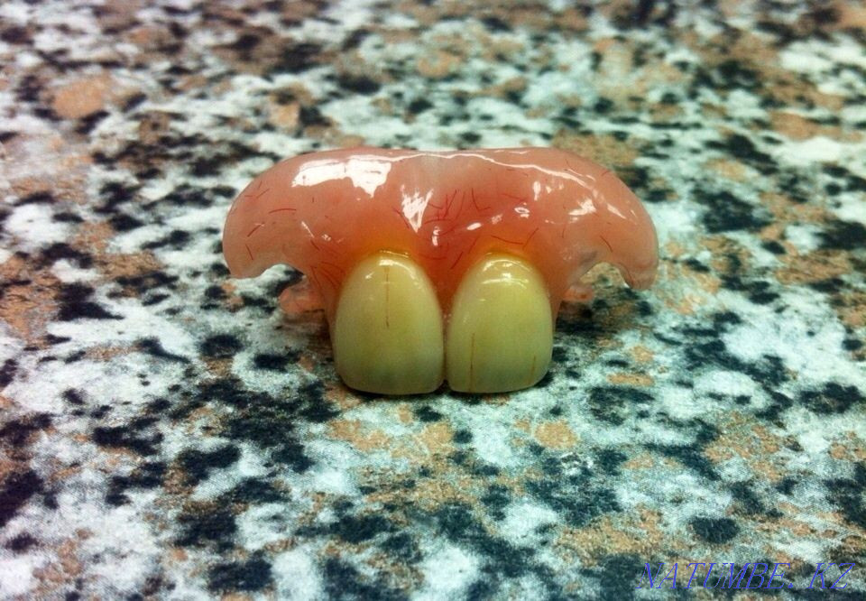 Dental laboratory offers its services! Astana - photo 1