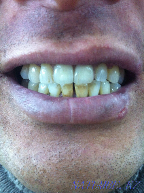 Dental laboratory offers its services! Astana - photo 3