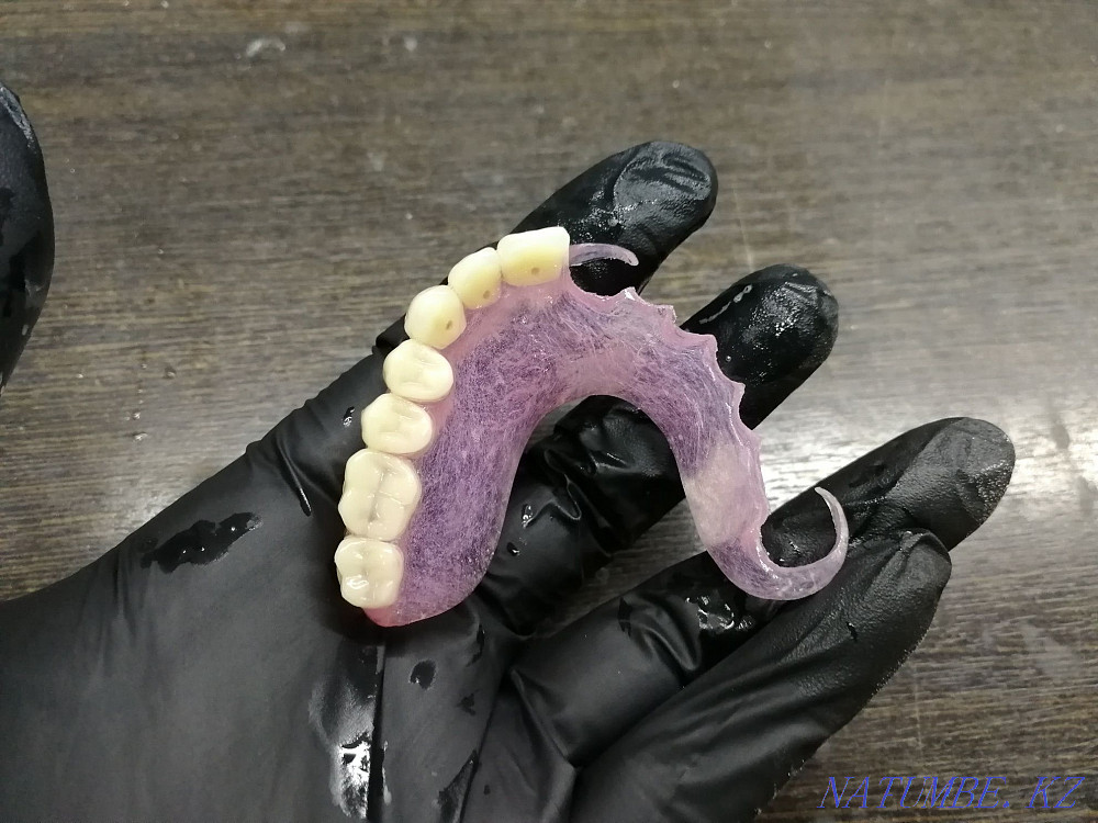 Dental laboratory offers its services! Astana - photo 5