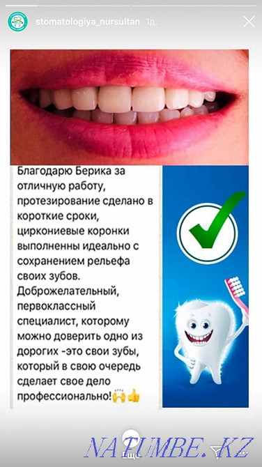 На все виды стоматологических услуг скидки Астана - изображение 2