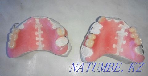 Denture repair Astana - photo 2