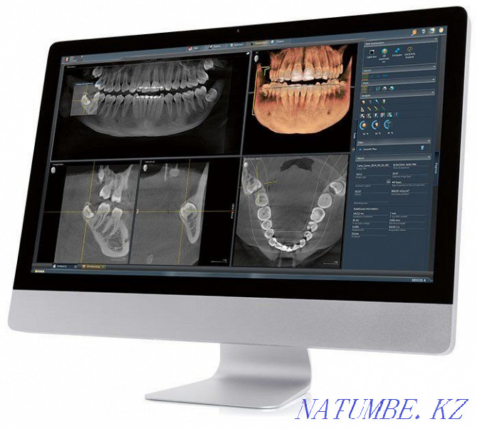 X-ray from 9.00 to 22.00 Almaty - photo 4