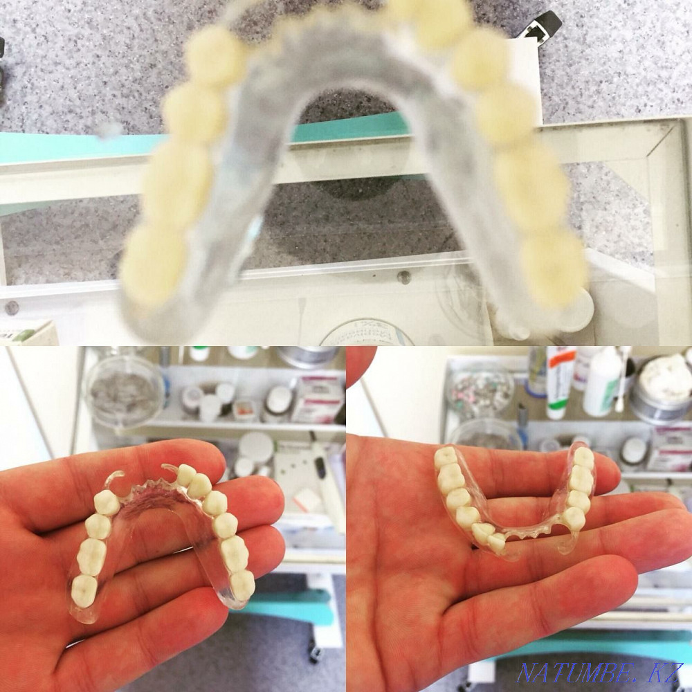 Implantation from 70 000tg Almaty - photo 7