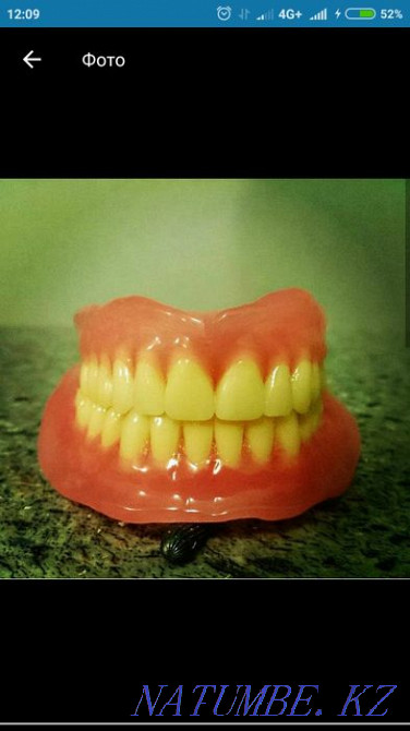 Implantation from 70 000tg Almaty - photo 4