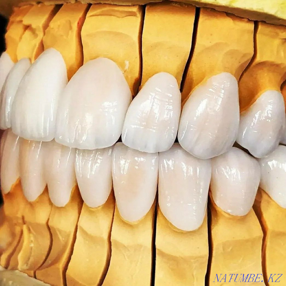 Manufacture and repair of prostheses Almaty - photo 6