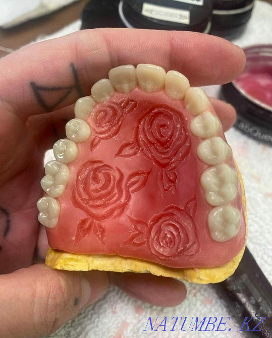 Manufacture and repair of prostheses Almaty - photo 4