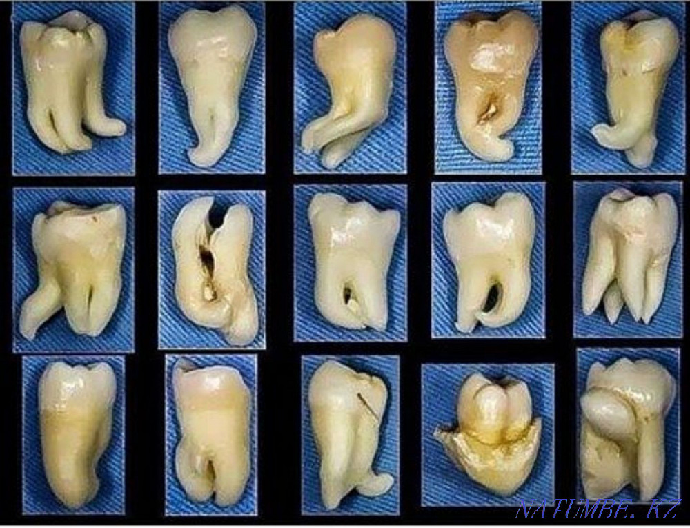 "Ночная Стоматология" Костанай - изображение 1