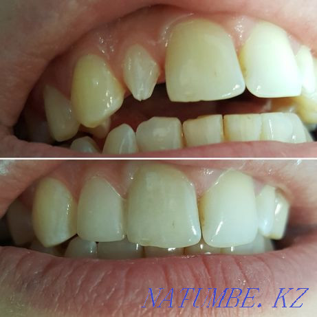 "Ночная Стоматология" Костанай - изображение 7