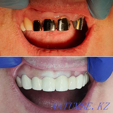 "Ночная Стоматология" Костанай - изображение 6