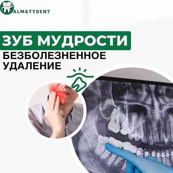 Импланты 55.000тенге. Акция в стоматологии.  Алматы