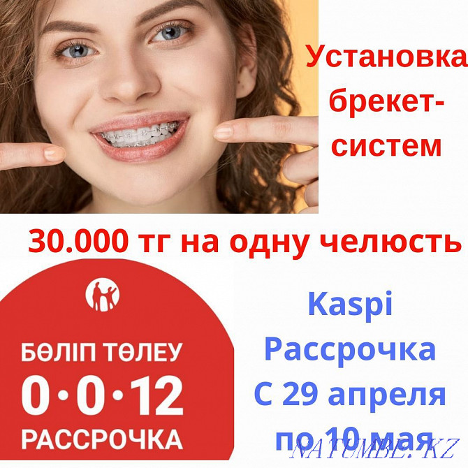 Braces Dentures Caries treatment Veneers Dentist Almaty Implants Almaty - photo 1