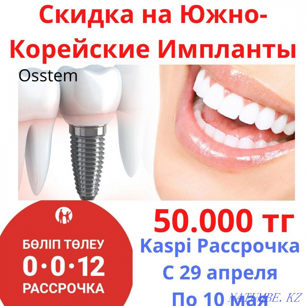 Implants Dental treatment Veneers Dentures Metal-ceramics Dentistry Almaty - photo 1