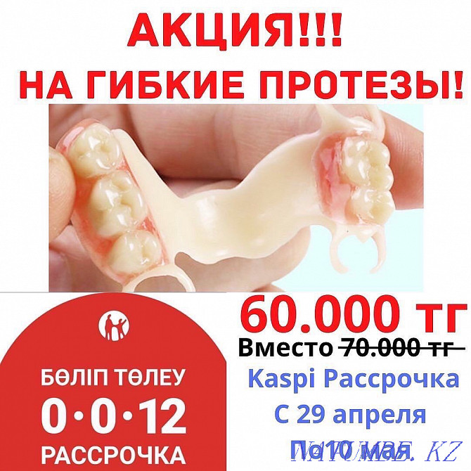 Dentures denture repair Dentistry Almaty Implants Braces Veneers Almaty - photo 1