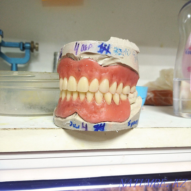 Протезировани зубов. Протездер жасаймыз Белоярка - изображение 6