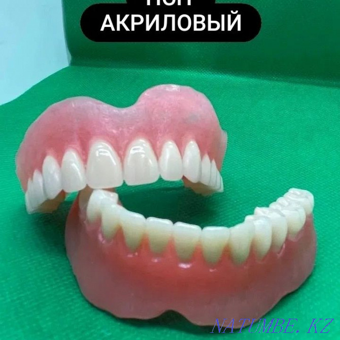 Протезировани зубов. Протездер жасаймыз Белоярка - изображение 2