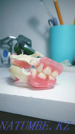 Протезировани зубов. Протездер жасаймыз Белоярка - изображение 4