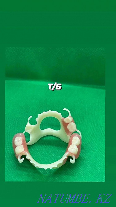 Протезировани зубов. Протездер жасаймыз Белоярка - изображение 1