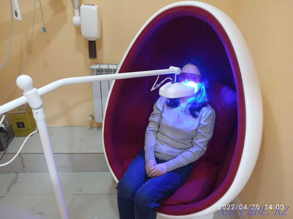 стоматология чистка отбеливания зубов Алматы - изображение 1