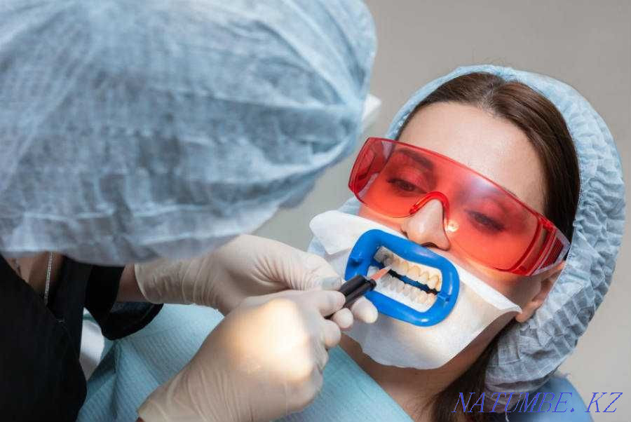 стоматология тазалау тіс ағарту  Алматы - изображение 2