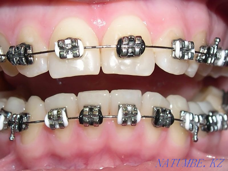 Dental Services Pavlodar - photo 3