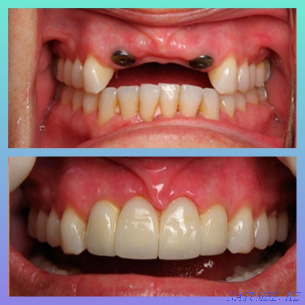 Dental Services Pavlodar - photo 5