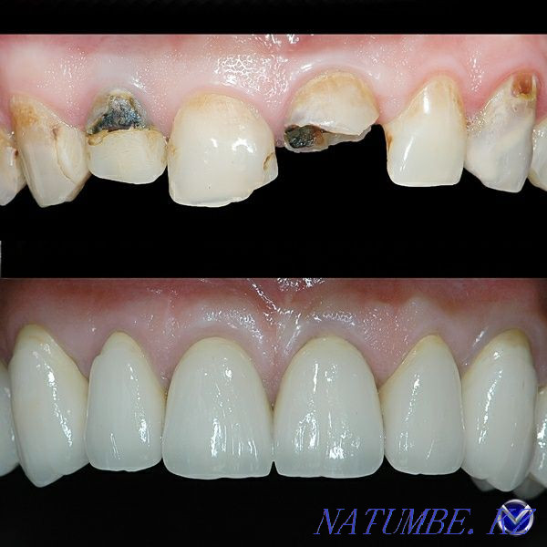 Dental Services Pavlodar - photo 4