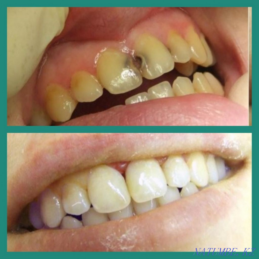 Dental Services Pavlodar - photo 2