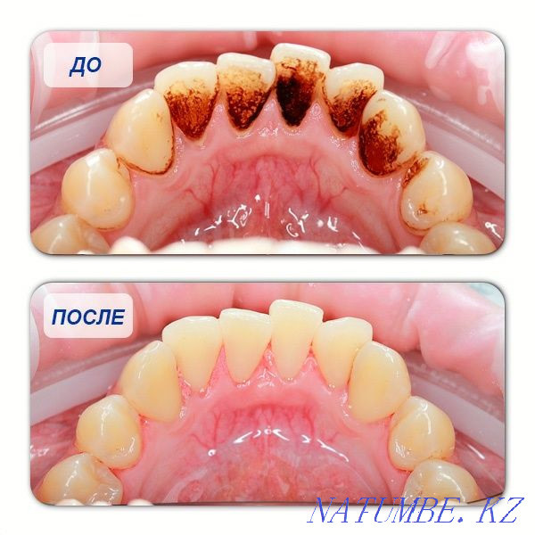 Dental Services Pavlodar - photo 7