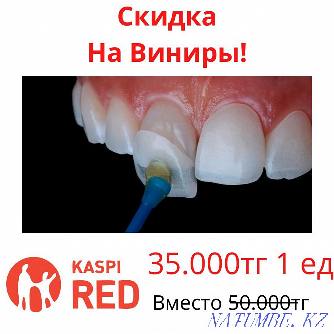 Veneers Dentistry Almaty Implants Dental treatment Braces Dentures Almaty - photo 1